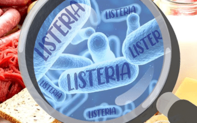 Listeria monocytogenes: un rischio da non sottovalutare nell’igiene alimentare